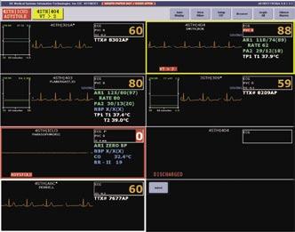 MUSE Cardiology System Assistance Display Multi-Patient Viewer The multi-patient viewer can display up to 16 patients. Beds can be locked into a particular window.