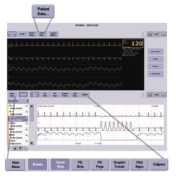 MUSE Cardiology System Assistance Patient Data Retrieval From the CIC Pro, you can retrieve in-unit parameter data from networked patient monitors as well as data from certain secondary devices.