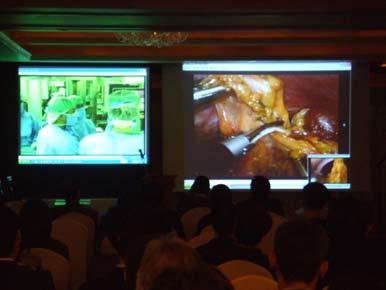 2 The live demonstration of laparoscopic distal Date 2006.10.