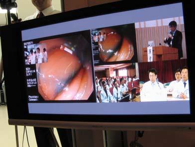 Hospital The live demonstration of endoscopy was held during 26 th