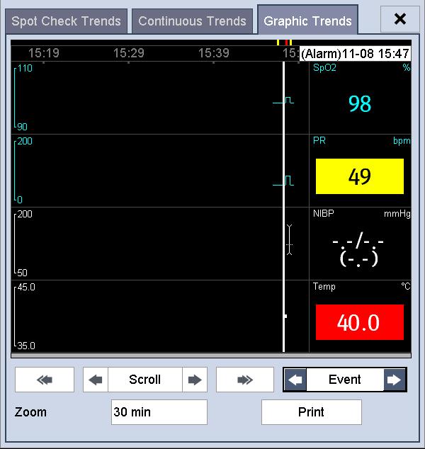 4.4.3 Graphic Trends Select [Graphic Trends] tab to access the Graphic Trends screen. The Graphic Trend screen displays the current patient's physiological trend. 1 2 3 4 5 6 1. Event mark area 2.