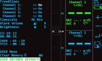 Operating Modes and Defaults How to Set Reference 1. Press Limits. 2. Press Next to select Reference for the desired channel. 3. Adjust the reference value using Plus (+) and Minus (-). 4.