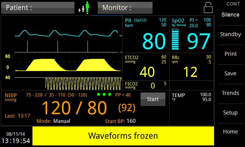 INTENDED USE AND PRINCIPLE OF OPERATION FREEZING WAVEFORMS In some clinical environments the user may want to freeze the displayed waveforms.