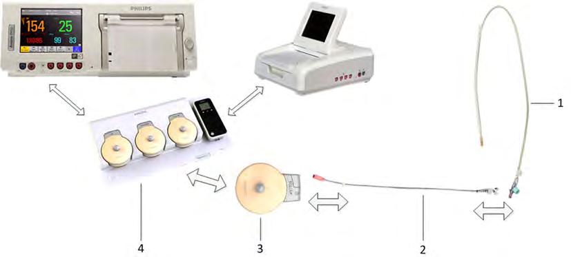 Illustration 3 shows the complete connection chain from the IUP catheter to the fetal monitor using the CL ECG/IUP transducer: 1 Disposable