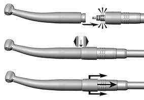 4. Operation Assembly/Removal Do not assemble or remove the turbine handpiece during the operation!