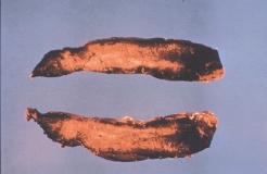 surface of the root is discolored. Copper-skinned sweet potatoes usually have brown lesions, and red-skinned sweet potatoes have black lesions.