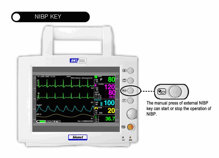 8.2 NIBP Data Window Alarm Limit:Indicates alarm limit of blood pressure.