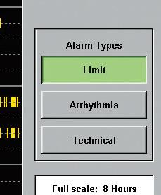 Alarm type hide and display button In the multi patient alarm event window, you can hide and display the alarm depending on the type of alarm.