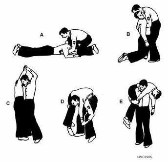 Emergency Moves You may need to carry the person using a two person