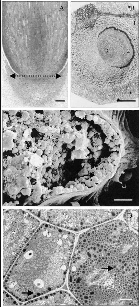 Alignment of lipid bodies along the plasma membrane in inner quiescent center cells of the embryo radicle after the seed was dried under different conditions in 1998, (A, B and