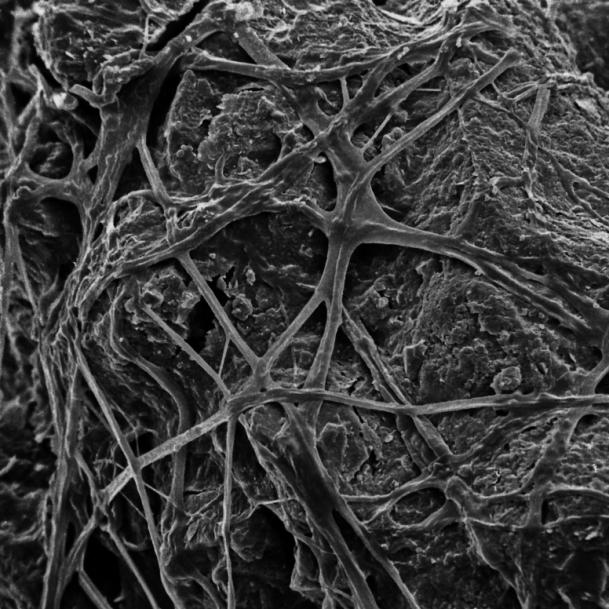 Netlike fungal mycelia can stabilize micro