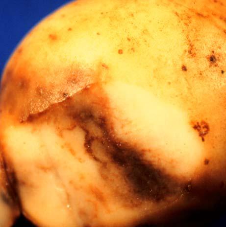 may appear shriveled as older lesions become firm and sunken due to water loss. Invasion by secondary decay organisms is common, resulting in the complete breakdown of tubers.