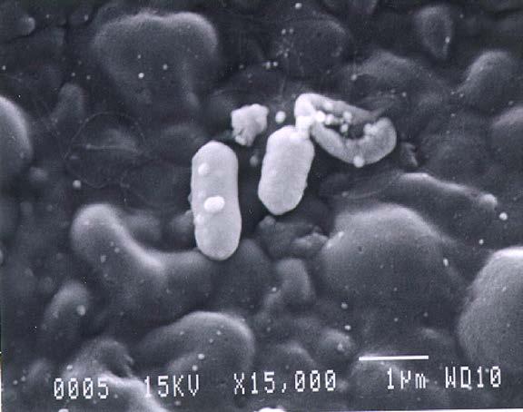 coli dried as a biofilm on a porous surface 1.