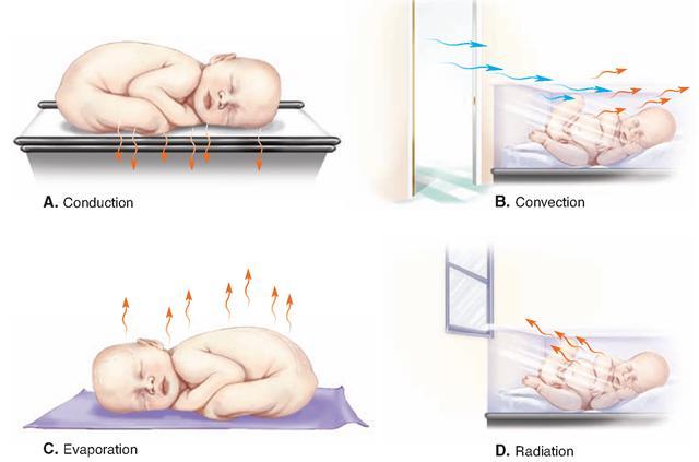 Product Study Heat loss & Types Heat loss in the newborn can be caused by any one, or a combination, of the following factors: (A) Conduction: heat loss due to direct contact with a colder surface.