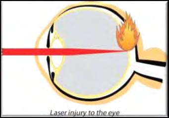 Safety Zones Laser safety