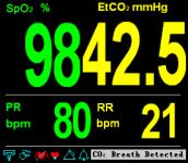 Displays and Functions (a) SpO 2 and CO 2 Module (b) CO 2 Only Figure 5-2: Big Chart Mode In the monitoring screen, press MUTE button to