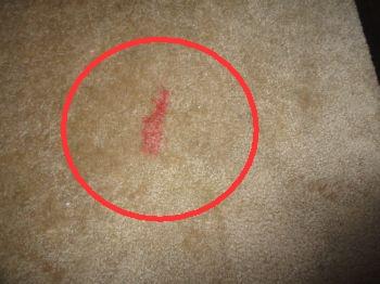 Carpet stains noted. The photographs depicted are only representative photographs of this condition. Recommend professional evaluation.
