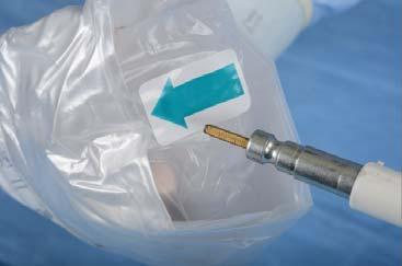 Flexshaft and Casing using a sterile probe/sleeve drape.
