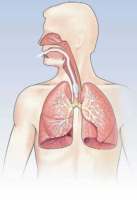 Respiratory Humidification Normal airway humidification is bypassed or compromised during ventilation or O 2 therapy Mucociliary transport system operates less