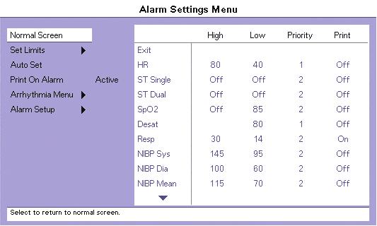 13.0 Alarms 13.1 Alarms The Passport V monitor provides a broad range of alarm settings. FIGURE 13-1 Alarm Settings Menu 13.1.1 Adjusting Alarms WARNING: The user should check that the current alarm settings on the Passport V monitor are appropriate prior to use on each patient.
