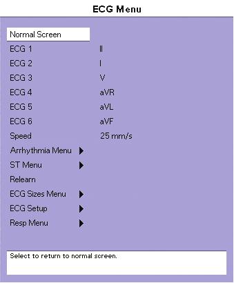Menus: ECG Main and Submenus ECG Monitoring 4.4 Menus: ECG Main and Submenus 4.4.1 ECG Menu FIGURE 4-6 ECG Menu To display the ECG Menu: 1.