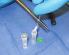 Simply swab the biopsy channel of the scope with the included soft-tipped long probe, clip off the swab into the vial.