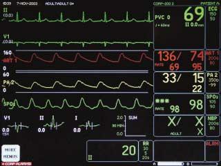 Components Display Date Time Unit Name Bed Number Patient Name Parameter Window More Menus Waveforms Time / Date ECG