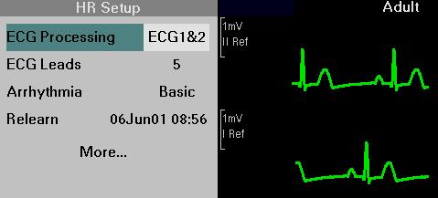 8 ECG AND HEART RATE One- or Two-Channel Signal Processing The monitor can process one or two ECG leads.