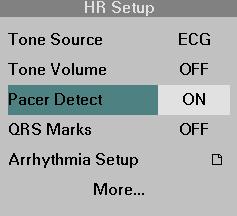 Pacer Detection ECG MONITORING SETTINGS Pacer detection is used for paced patients in the adult and pediatric monitoring modes.