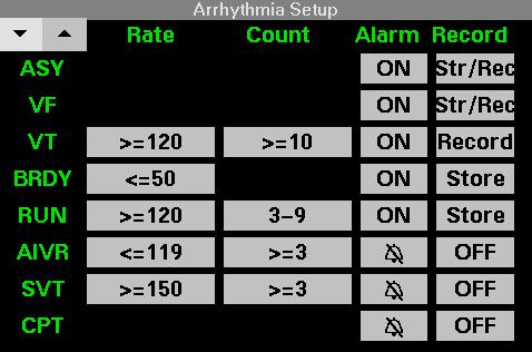 ARRHYTHMIA SETUP Arrhythmia Setup The Arrhythmia Setup table lets you set Rate and Count limits for certain arrhythmia parameters and turn alarms and alarm recordings on or off.