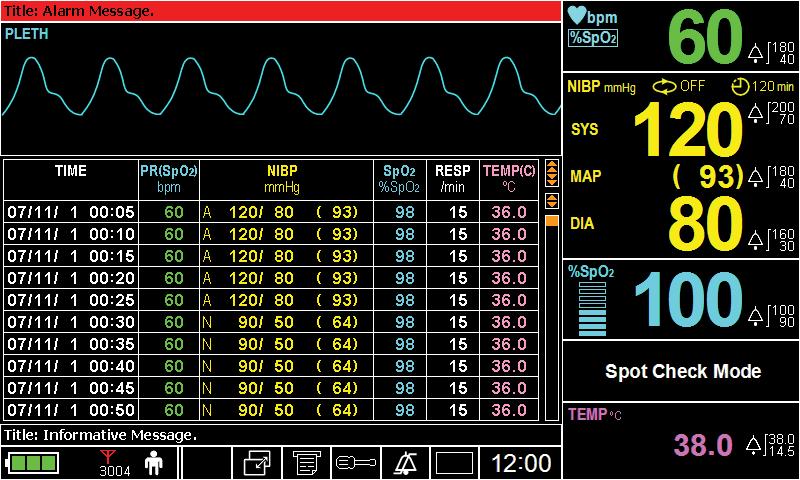 Figure 37. Tabular Trend Screen of Spot Check Mode Note: The monitor cannot communicate with Central station while in the Spot Check Mode.
